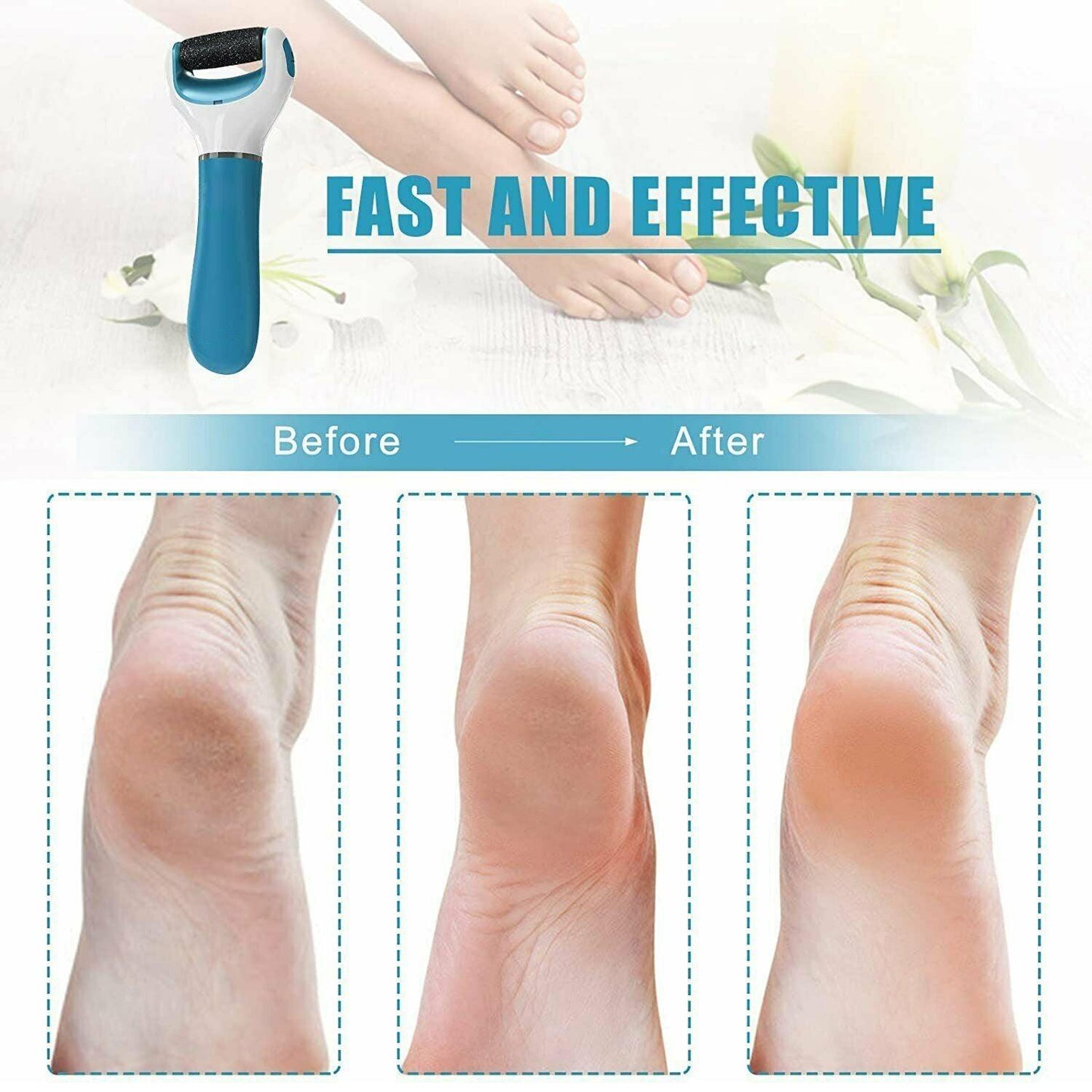 0229 Electronic Dry Foot File Callous Remover For Feet Electric Foot With Roller Hard And Dead Skin- Regular Coarse Baby Smooth Feet In Minutes. For In Home Padicure Foot Care Battery Powered Usb (Battry Not Included) - Springkart