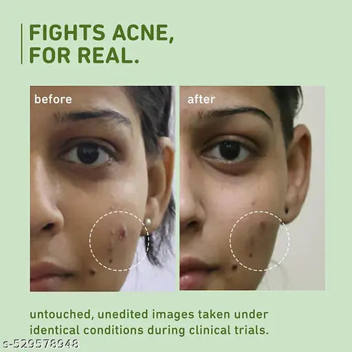 Plum Green Tea Pore Cleansing Face Wash| Acne-Prone Skin | Controls Oil 100ml + Freebie Niacinamide Sunscreen 15g