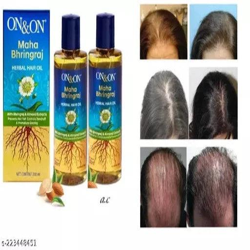 ON and ON HAIR CARE HAIR GROWTH ….. HAIR OIL PACK OF 2 - Springkart