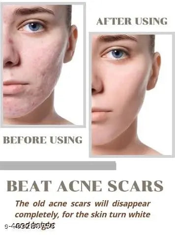 Natural Niacid Face Serum - Skin Brightening Serum , Anti-Aging, Skin Repair,(30ML) Pack of 1 - Springkart