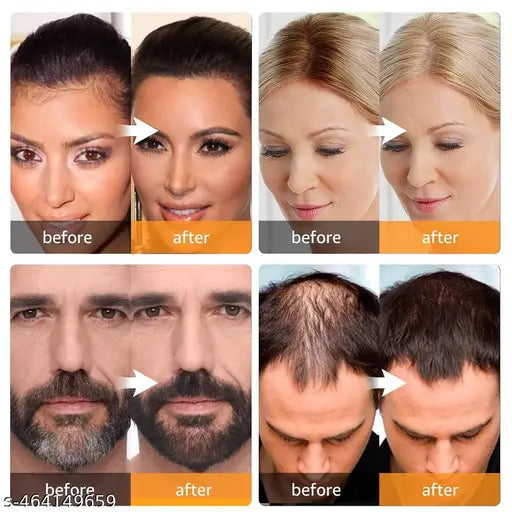 Root Touch Up Shadow Powder,Instantly Concealer Hair Loss Beard Line Eyebrow, Black - Springkart