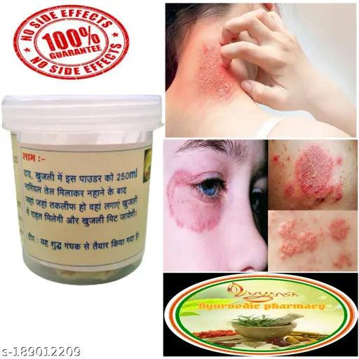 Ayurvedic Store, medicine,skin dieseace,dad, dinay,aphras,eczema,dad khaj khujli ki dava,charm rog.(pack of 1) - Springkart