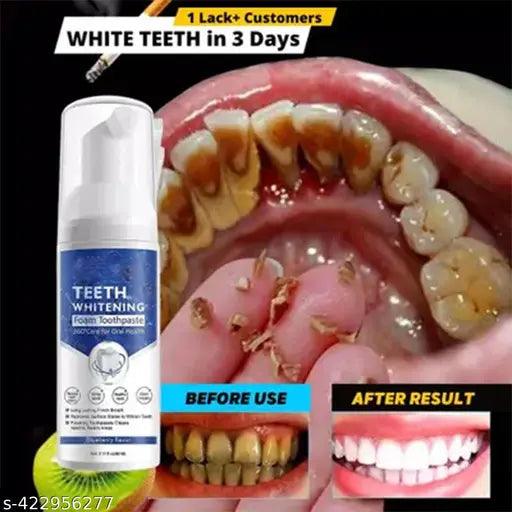 Teeth Whitening Foam Toothpaste Makes You Reveal Perfect & White Teeth,Deeply Clean-(60ml) - Springkart
