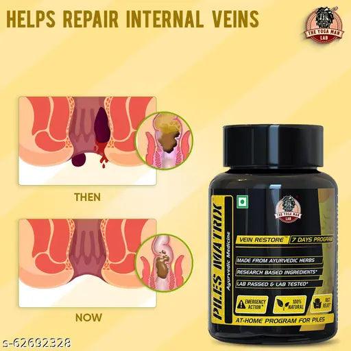 Piles Matrix Vein Restore Ayurvedic Supplement To Heal Ruptured Veins & Guide - Springkart