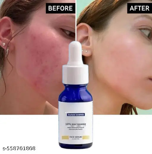 2% Kojic Night Cream (50g) | With Niacinamide & Alpha Arbutin | Face Moisturizer For Glowing & Brightening Skin | Reduces Dark Spots & Pigmentation | Minimizes Pores | Anti Agi+ 5% Glycolic Aci d Underarm Brightening Spray Treatment