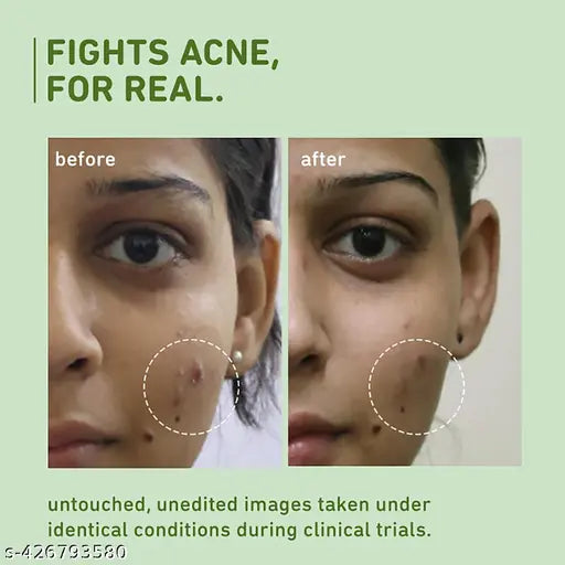 Plum Green Tea Pore Cleansing Face Wash|100ml Acne-Prone Skin | Controls Oil, Fights Pimples