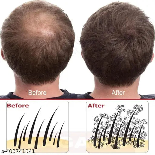 Natural Caboki Hair Fiber Buliding 25 gram Black (Refill Pack) Pack of 4 - Springkart