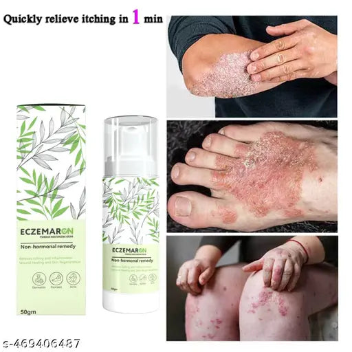Anti Fungal Cream For Men & Women. (50 ml) - Springkart