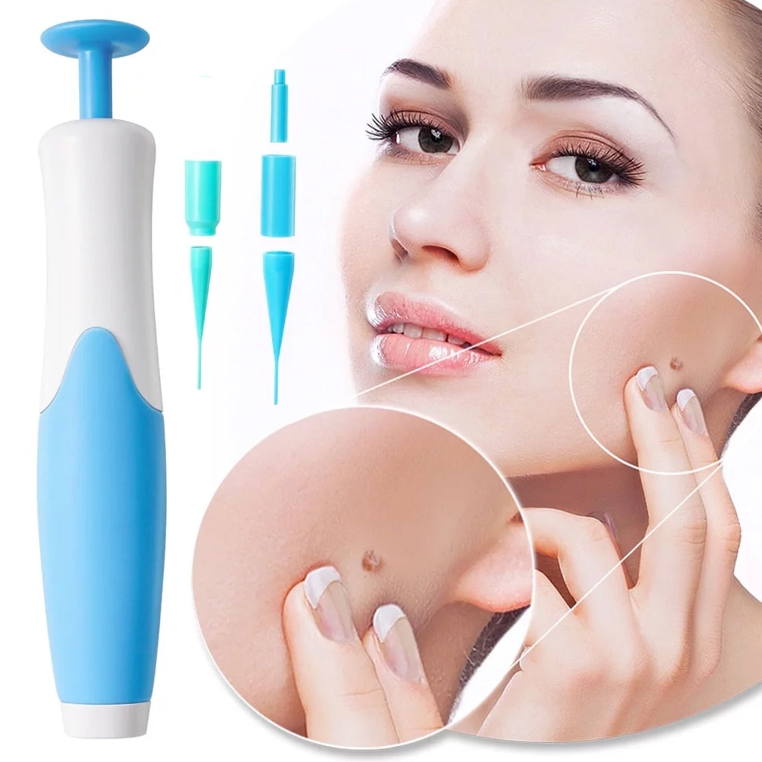 Skin Tag Remover Kit 2 in 1 for Micro to Large (2 mm - 8 mm / 1 Set) - Springkart 