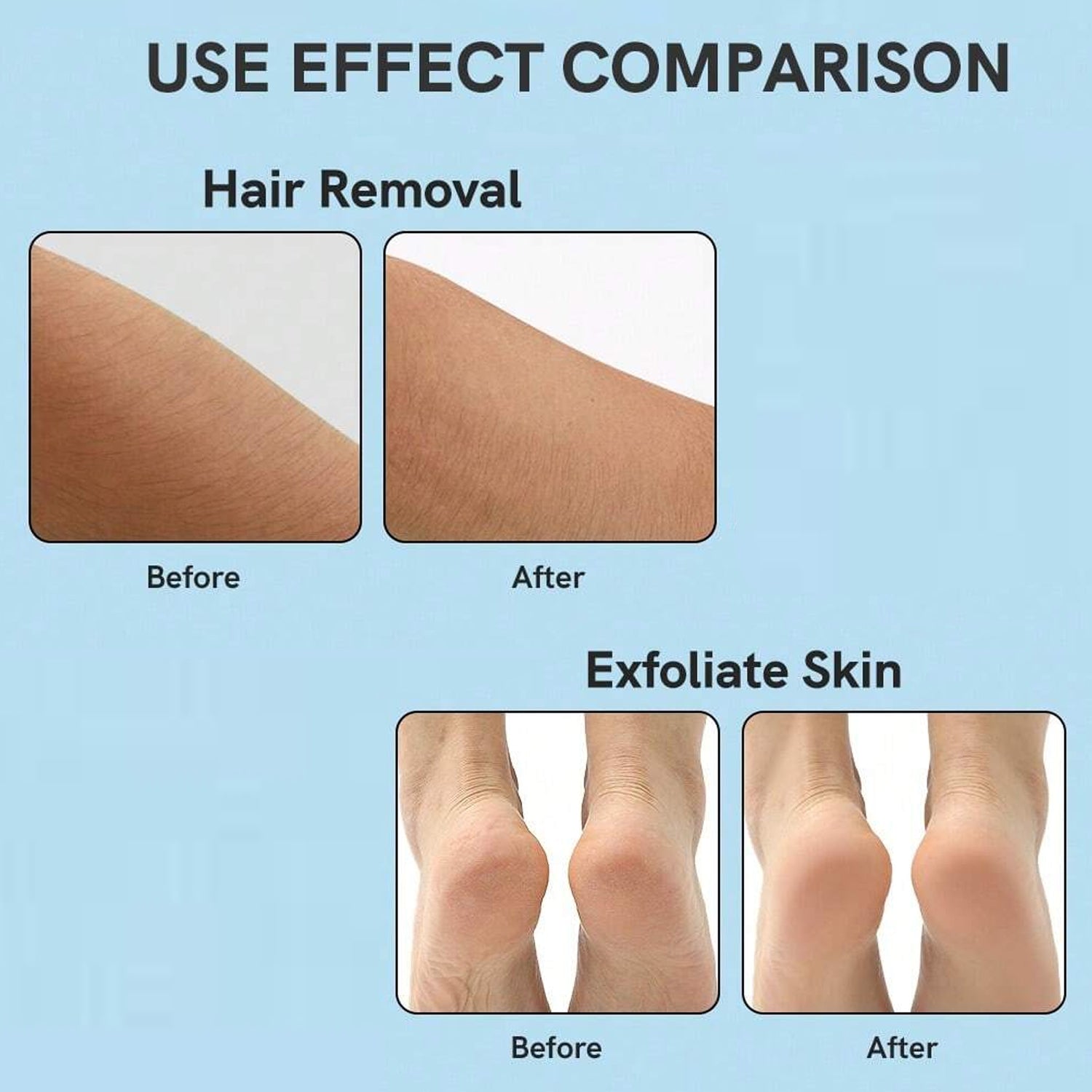 Nano Hair Remover for Arms, Legs, Back One Sided Skin Hair Remover (1 Pc) - Springkart 