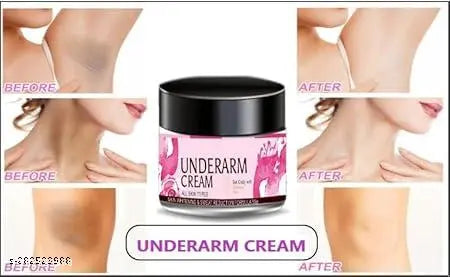 Advanced UndeR-Arm Whitening Cream (50 Gm)Pack of 1