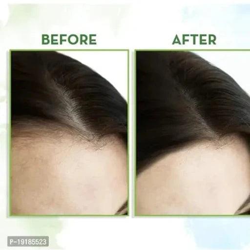 Mamaearth Rosemary Hair Growth Oil with Rosemary Methi Dana for Promoting Hair Growth - 150 ml - Springkart 