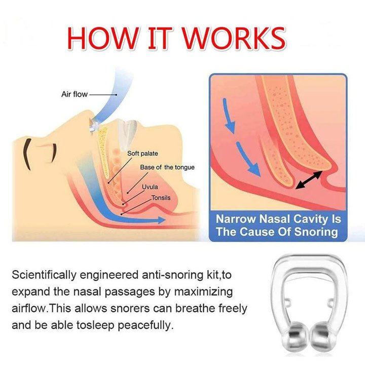 Snore Free Nose Clip (Anti Snoring Device) - 1pc - Springkart 