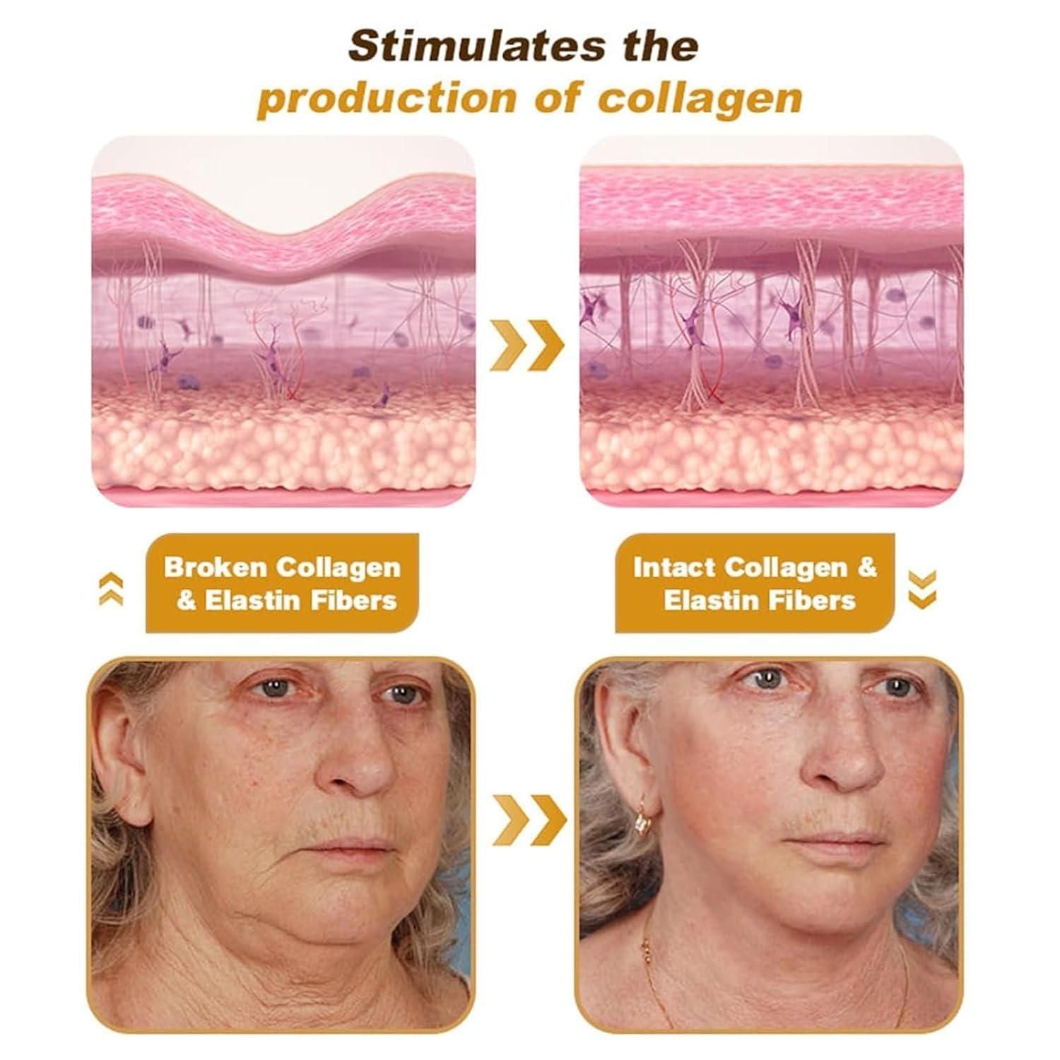 Botox Bee Venom Cream 20g (Pack of 2) - Springkart 