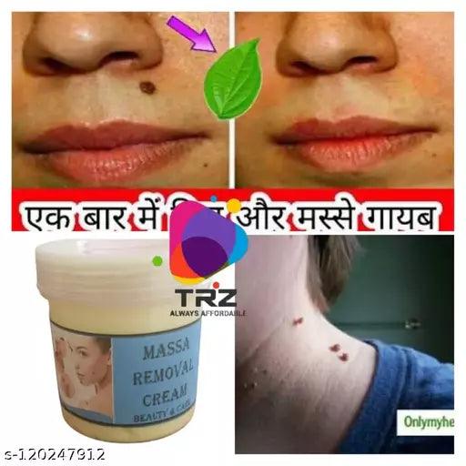 Massa,Wart Removing 100% Herbal Ayurvedic cream - Springkart 