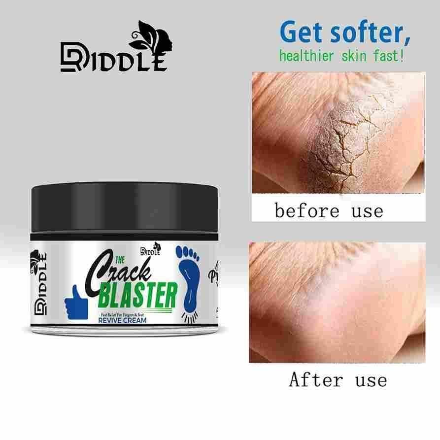 Driddle Foot Crack Remover Cream For Women & Men Pack of 2 - Springkart 