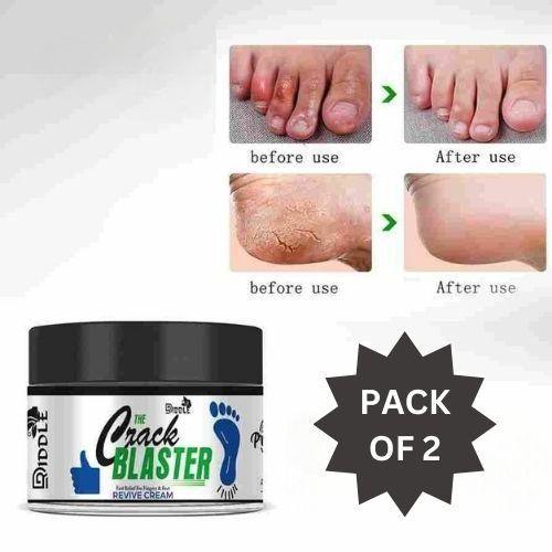 Driddle Foot Crack Remover Cream For Women & Men Pack of 2 - Springkart 