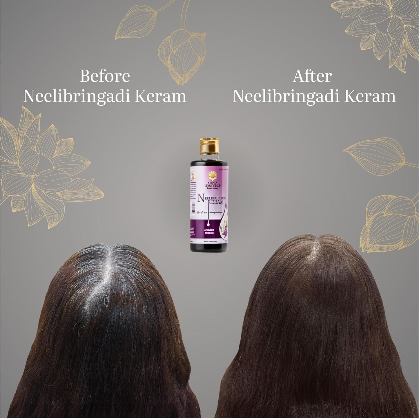 Kerala Ayurveda Neelibringadi Keram Liquid - 200 ml - Springkart 