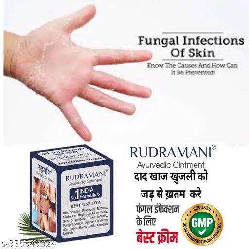 Ayurvedic ItchCoat Anti fungal Malam - for Ringworm, itching, Eczema & Fungal Infection-50gm-Pack of -(2)