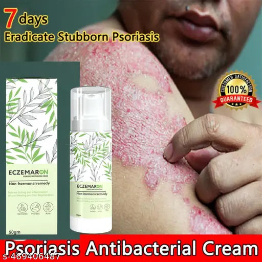 Anti Fungal Cream For Men & Women. (50 ml)