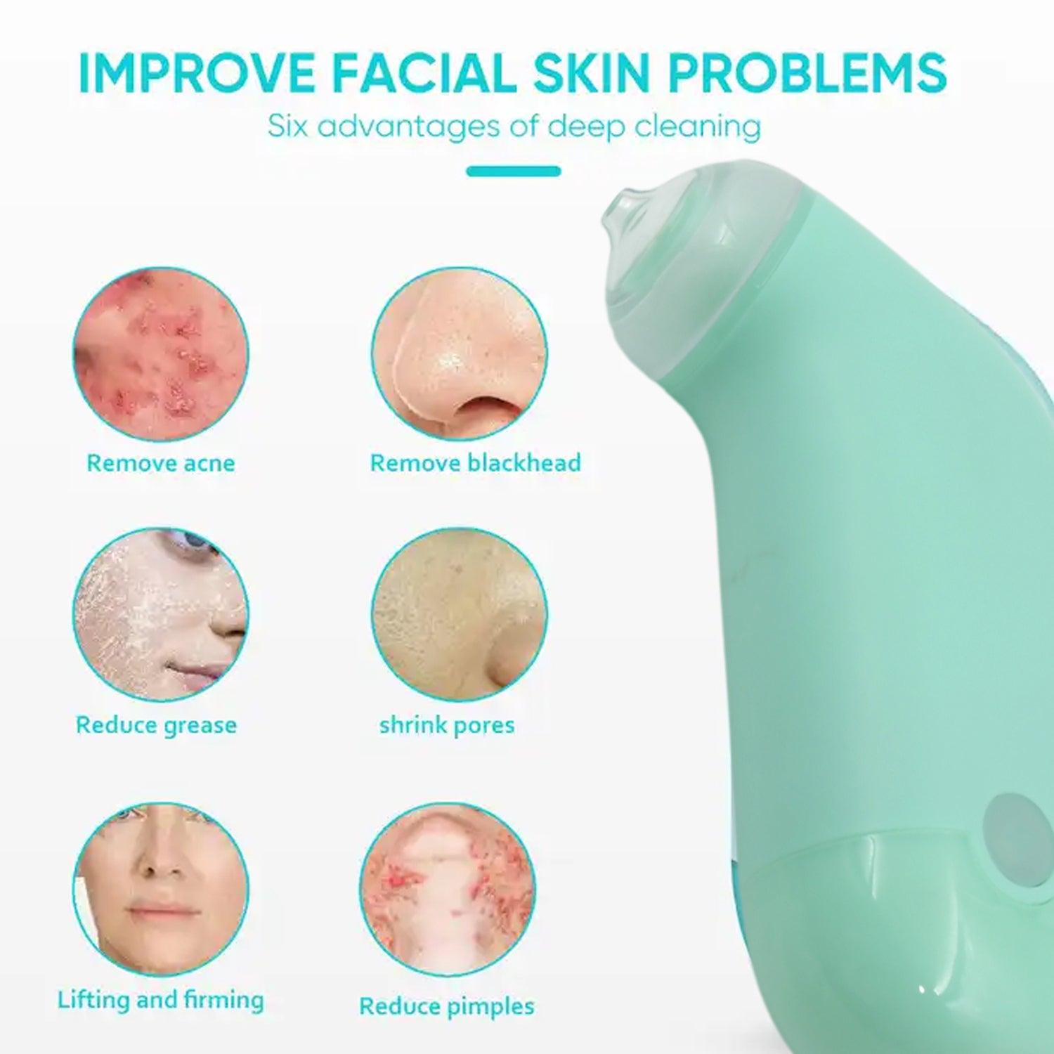 0288 Vacuum Blackhead Machine Reduce Spot Mini Handheld Lifting Massage Facial Blackhead Remover For Skin Care (1 Pc) - Springkart 