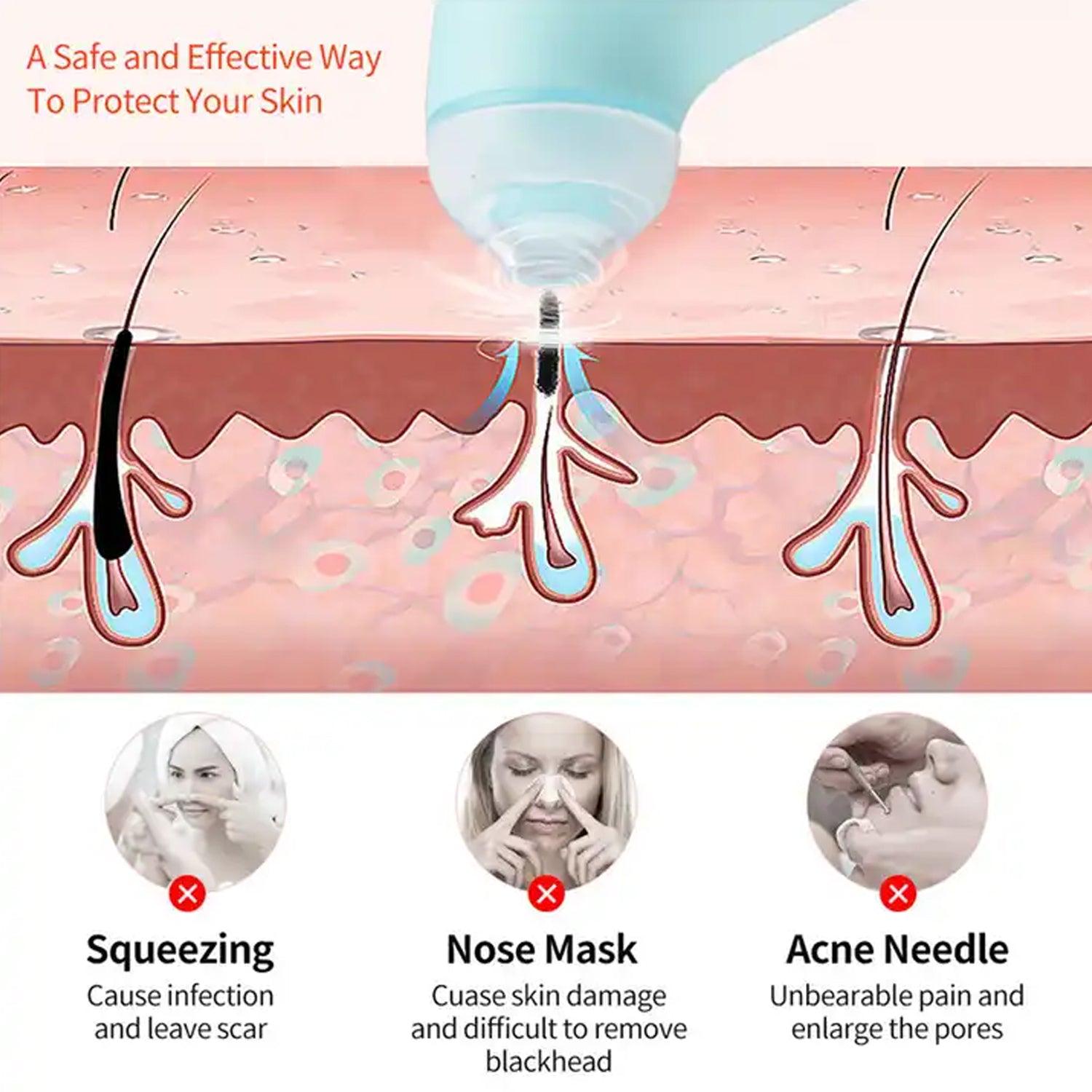 0288 Vacuum Blackhead Machine Reduce Spot Mini Handheld Lifting Massage Facial Blackhead Remover For Skin Care (1 Pc) - Springkart 