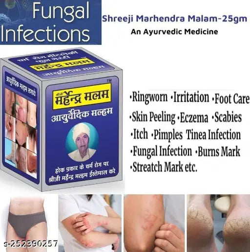 Sheeji Mahendra Ayurvedic Anti fungal Malam - for Ringworm, itching, Eczema ,Burn Mark, Foot Care - Springkart 