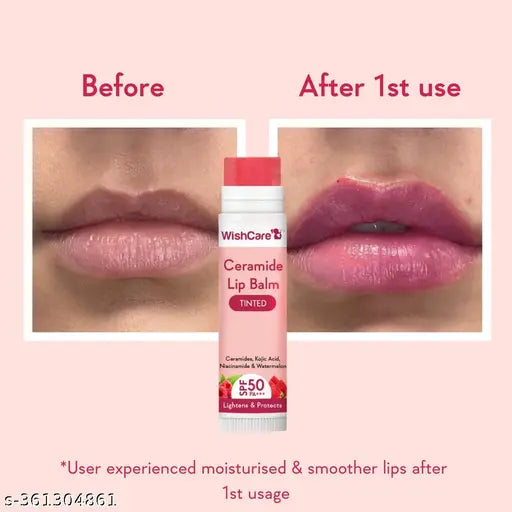 WishCare Tinted Ceramide Lip Balm with SPF50 PA+++ - Kojic Acid & Niacinamide - For Lip Lightening, Sun Protection & Long Lasting Hydration - 5gm