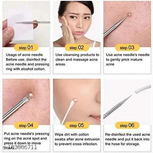 Stainless Steel Blackhead Pimple Blemish Extractor/Remover Tool