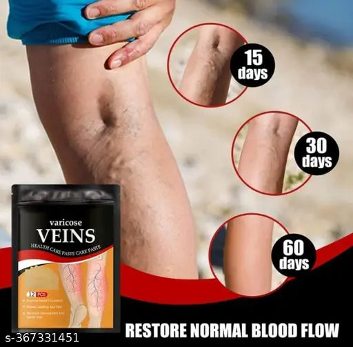 (12Pcs) Varicose Veins Patches Skin-Friendly Non-Toxic Improve Varicosity Dredge Vein Relieve