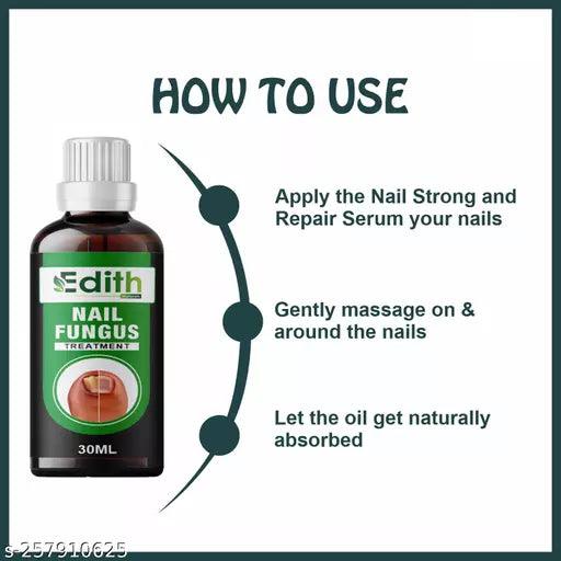 Premium Nail & Cuticle Growth Oil- For Nail Growth, Repair & Cuticle Care 30ML - Springkart 