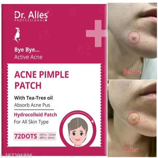 Dr.Alies Pimple Patches for Face (72 Dots), Hydrocolloid Acne Patches with Tea Tree Oil