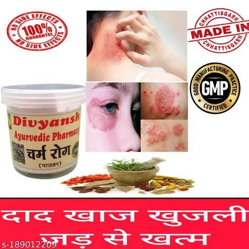 Ayurvedic Store, medicine,skin dieseace,dad, dinay,aphras,eczema,dad khaj khujli ki dava,charm rog.(pack of 1)