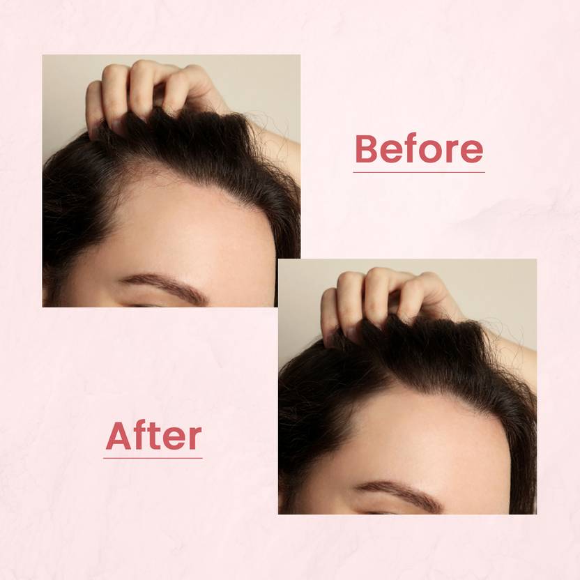 Nat Habit Hibiscus Hair Oil, Shampoo and Conditioner Combo | 3-in-1 Complete Hair Care Kit  (3 Items in the set)