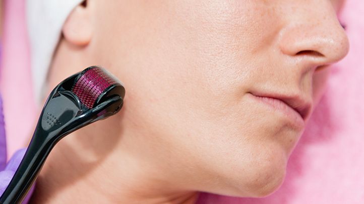 Derma Roller Anti Ageing and Facial Scrubs & Polishes Scar Removal Hair Regrowth - Springkart 