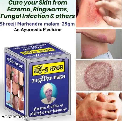 Sheeji Mahendra Ayurvedic Anti fungal Malam - for Ringworm, itching, Eczema ,Burn Mark, Foot Care - Springkart