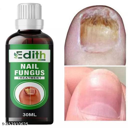 Premium Nail & Cuticle Growth Oil- For Nail Growth, Repair & Cuticle Care 30ML - Springkart 