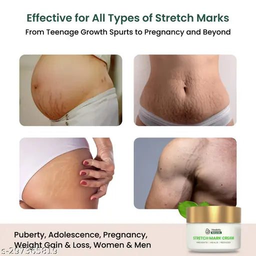 Stretch Marks Cream - Advanced Stretch Mark Removal Cream