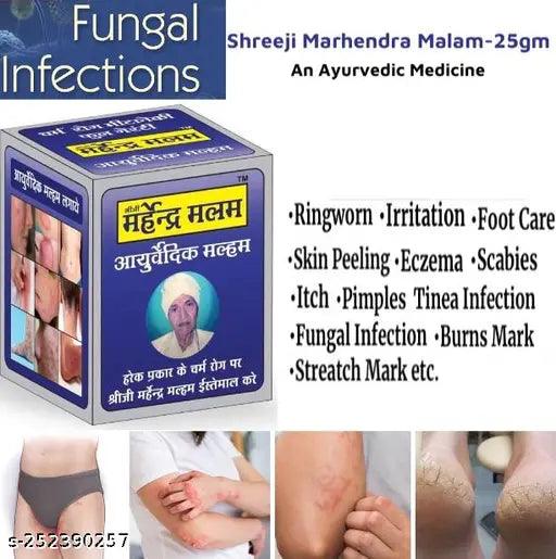 Anti fungal Malam - for Ringworm, itching, Eczema ,Burn Mark, Foot Care & Skin Infection, Skin Tretment, Skin Care Cream For Men And Women