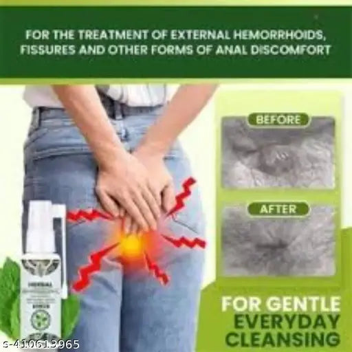 Holistic Hemorrhoids : 100% Natural Herbal and Gentle Spray Liquid