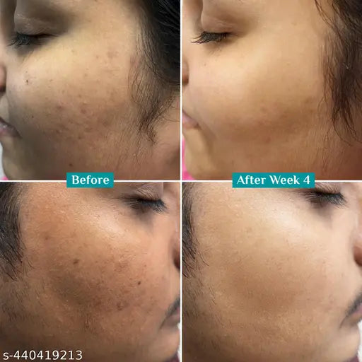 PILGRIM 10% Vitamin C Face Serum For Daily Brightness (10 ml)