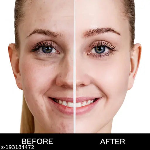 FACES CANADA Weightless Matte Finish Foundation - Ivory, 15ml | Lightweight | Natural Finish | Anti-Ageing | Non-Clog Pores | Enriched With Olive Seed Oil, Grape Extract, Shea Butter