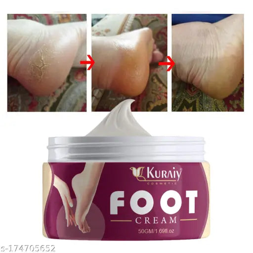 Best Crack Cream For Dry Cracked Heels & Feet. - Springkart 