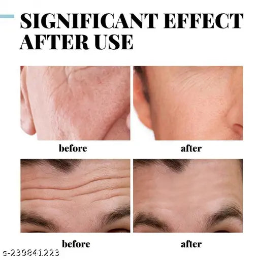 Retinol Lifting Firming Cream Remove Wrinkle Anti-Aging Fade Fine Lines Face Whitening Brighten Skin Beauty Health Care