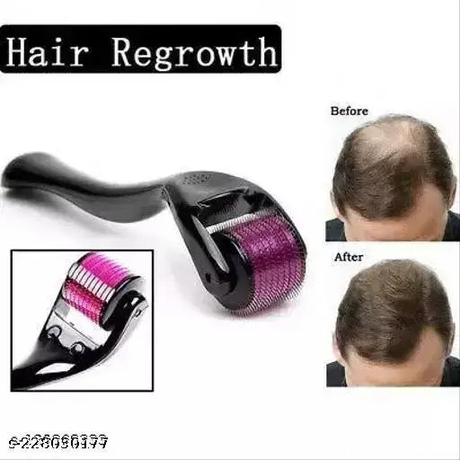 Derma Roller 540 Micro Needles Treating Acne Scars, Wrinkles, Blackheads, Skin Ageing, Hair Regrowth (0.5mm) Face Rollers - Springkart 