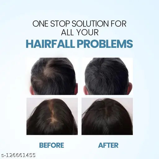 Nature Sure Jonk Tail Hair Oil for Men and Women - 1 Pack (150 ml) - Springkart 