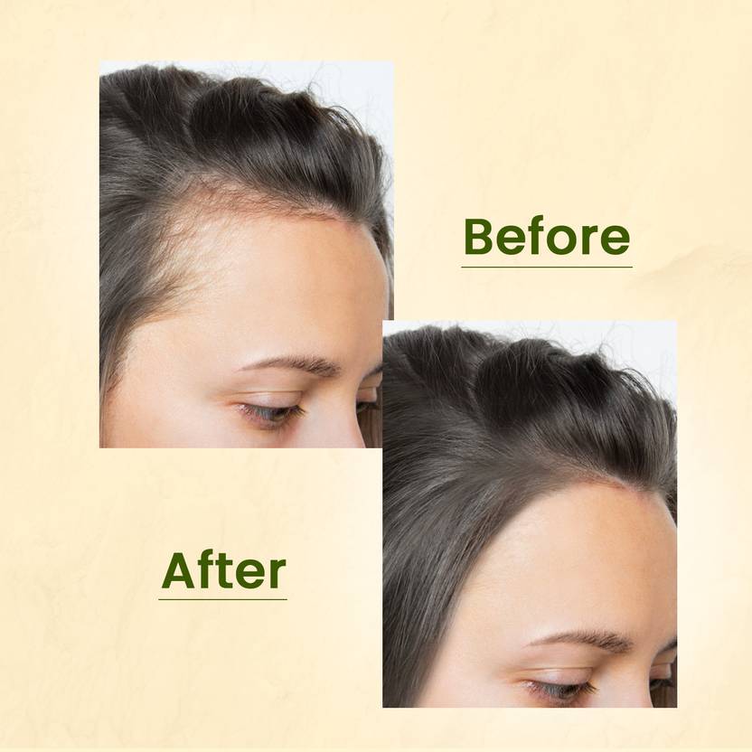 Nat Habit Rosemary Hair Oil, Shampoo and Conditioner Combo | 3-in-1 Complete Hair Care Kit (3 Items in the set)