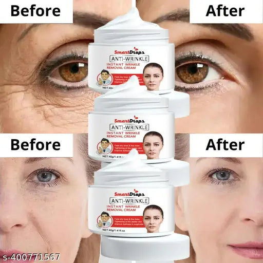 Anti Wrinkle Radiance Rejuvenating Anti-ageing Cream (50g) Pack Of 3 - Springkart 