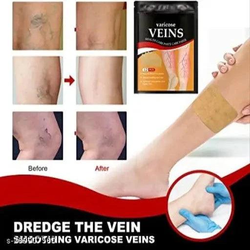 (12Pcs) Varicose Veins Treatment Patch Blood Circulation Patch