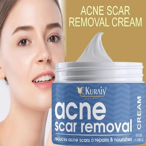 KURAIY ACNE SCAR CREAM - Springkart 